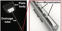 Purdue's Giant Leap Toward Personalized Medicine Helps Eyes Drain Themselves