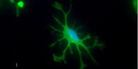 Axol Bioscience Launches Human iPSC-Derived Microglia