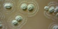 Bacteria Found in Ancient Irish Soil Halts Growth of Superbugs