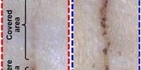 E-Bandage Generates Electricity, Speeds Wound Healing in Rats