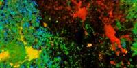 How Concussions May Lead to Epilepsy