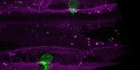 Study May Explain Why Once-Promising Cancer Drugs Failed