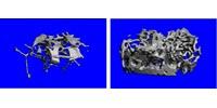 Ultra-Sturdy Bones, with a Surprising Origin, Suggest New Osteoporosis Approach