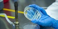 More Scrutiny Needed for Less-Deadly Foodborne Bacteria