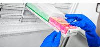 More Than 100 New Gut Bacteria Discovered in Human Microbiome