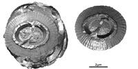 The Smallest Skeletons in the Marine World Observed in 3D by Synchrotron Techniques