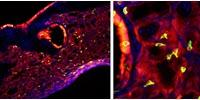 A Bad Bout of Flu Triggers 'Taste Bud Cells' to Grow in the Lungs