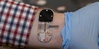 Sweat Holds Most Promise for Noninvasive Testing