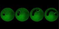 An Army of Micro-Robots Can Wipe out Dental Plaque