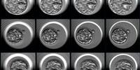 Artificial Intelligence Approach Optimizes Embryo Selection for IVF