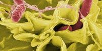 More Severe Salmonella Outbreaks Ahead