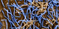 Newly Discovered Ebolavirus May Not Cause Severe Disease in Humans