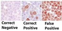 Researchers Find Widely 'Inconsistent' Use of Antibodies in Lab Experiments