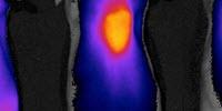 A Homing Beacon for Chemotherapy Drugs