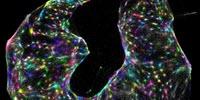 'DNA Microscopy' Offers Entirely New Way to Image Cells