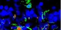 Immune System Can Slow Degenerative Eye Disease, Mouse Study Shows