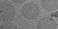 Innovative Technique Uses Sensory Nanoparticles to Detect Disease