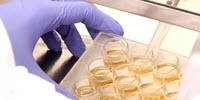 New Research Shows Parkinson's Disease Origins in the Gut