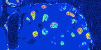 To Scientists’ Surprise, Organs Are a Mix of Young and Old Cells