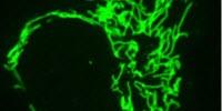 It's Not an Antibody, It's a Frankenbody: A New Tool for Live-Cell Imaging