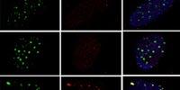 Molecular Sensor Scouts DNA Damage and Supervises Repair