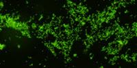 New Monoclonal Antibodies to Gardnerella Vaginalis