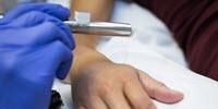 Pain Signaling in Humans More Rapid Than Previously Known