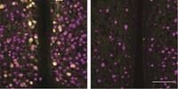 Scientists Find Clue to 'Maternal Instinct'
