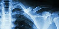 'Bone in a Dish' Opens New Window on Cancer Initiation, Metastasis, Bone Healing