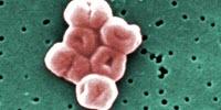 Antiseptic Resistance in Bacteria Could Lead to Next-Gen Plastics