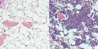 Drug Accelerates Blood System’s Recovery after Chemotherapy, Radiation