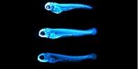 Glowing Cholesterol Helps Scientists Fight Heart Disease