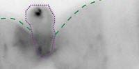Gut Throws Cells Overboard When Chemical Insults Build Up