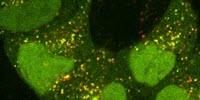 Insight into Cells' 'Self-Eating' Process Could Pave the Way for New Dementia Treatments