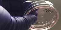 Machine Learning Algorithm Can't Distinguish These Lab Mini-Brains from Preemie Babies