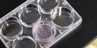 Mini Kidneys Grown from Stem Cells Give New Insights into Kidney Disease and Therapies