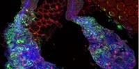 Mosquito 'Spit Glands' Hold Key to Curbing Malaria, Study Shows