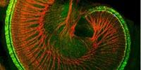 Researchers Find Proteins That Might Restore Damaged Sound-Detecting Cells in the Ear