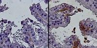 Study Links Progenitor Cells to Age-Related Prostate Growth