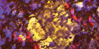 The Chemistry of Art: Scientists Explore Aged Paint in Microscopic Detail to Inform Preservation Efforts