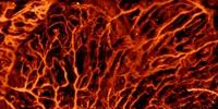 Artificial Intelligence Improves Biomedical Imaging