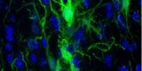 In Mice: Transplanted Brain Stem Cells Survive without Anti-Rejection Drugs