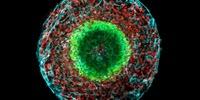 Study Gives Clues to the Origin of Huntington's Disease, and a New Way to Find Drugs
