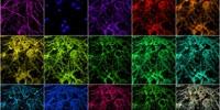 Technique Can Image Individual Proteins within Synapses