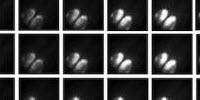 Brain Tissue Kept Alive for Weeks on an Artificial Membrane
