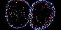 CNIO Uses Organoid Technology and Single-Cell Sequencing to Advance the Study of Bladder Cancer