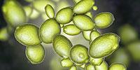 Deepest Look yet at Brewer’s Yeasts Reveals the Diversity Harnessed by Humans