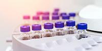 NDMA Testing Methods