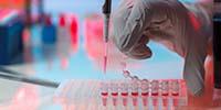 New Technologies for Electrophoresis
