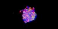Researchers Show Potential Liver Cancer Treatment by Targeting Cancer Stem-Like Cells